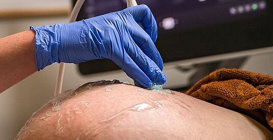 afbeelding Baby minder voelen bewegen